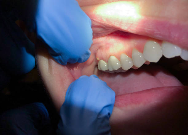 Best Walk-In Emergency Dentist in Cheyenne, WY