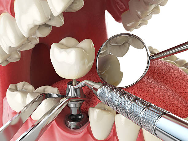 Best Emergency Treatment for Toothache in Cheyenne, WY
